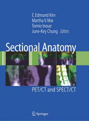 Sectional Anatomy: PET/CT and SPECT/CT de E. Edmund Kim