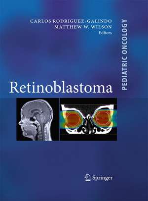 Retinoblastoma de Carlos Rodriguez Galindo