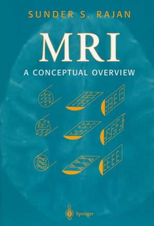 MRI: A Conceptual Overview de Sunder S. Rajan