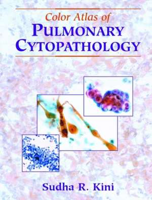 Color Atlas of Pulmonary Cytopathology de Sudha R. Kini