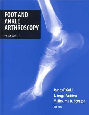 Foot and Ankle Arthroscopy de James F. Guhl