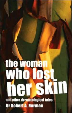 The Woman Who Lost Her Skin: (And Other Dermatological Tales) de Rob Norman