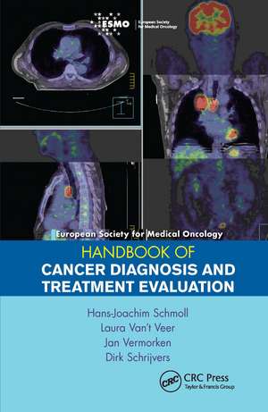 ESMO Handbook of Cancer Diagnosis and Treatment Evaluation de Hans-Joachim Schmoll