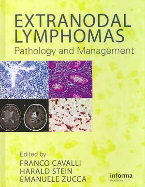 Extranodal Lymphomas: Pathology and Management de Franco Cavalli