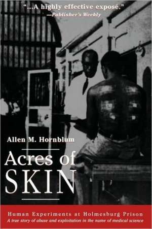 Acres of Skin: Human Experiments at Holmesburg Prison de Allen M. Hornblum