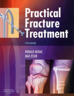 Practical Fracture Treatment de Ronald McRae