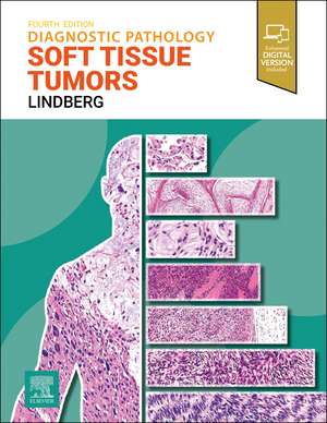 Diagnostic Pathology: Soft Tissue Tumors de Matthew R. Lindberg