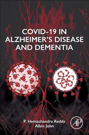 COVID-19 in Alzheimer's Disease and Dementia de P. Hemachandra Reddy