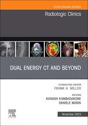 Dual Energy CT and Beyond, An Issue of Radiologic Clinics of North America de Avinash Kambadakone