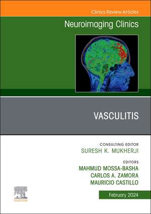 Vasculitis, An Issue of Neuroimaging Clinics of North America de Mahmud Mossa-Basha