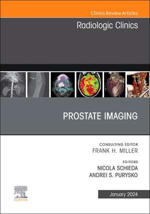 Prostate Imaging, An Issue of Radiologic Clinics of North America de Nicola Schieda