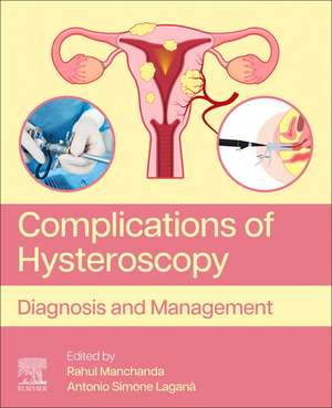 Complications of Hysteroscopy: Diagnosis and Management de Rahul Manchanda