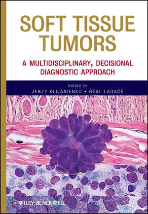 Soft Tissue Tumors – A Multidisciplinary, Decisional Diagnostic Approach de J Klijanienko