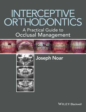 Interceptive Orthodontics – A Practical Guide to Occlusal Management