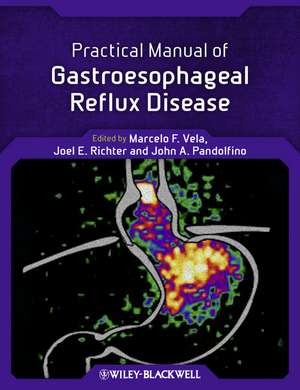 Practical Manual of Gastroesophageal Reflux Disease de MF Vela