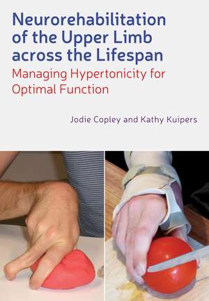 Neurorehabilitation of the Upper Limb Across the Lifespan – Managing Hypertonicity for Optimal Function de J Copley