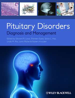 Pituitary Disorders – Diagnosis and Management de ER Laws