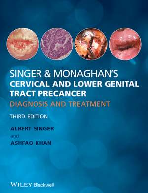 Singer & Monaghan′s Cervical and Lower Genital Tract Precancer – Diagnosis and Treatment 3e de A Singer