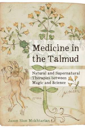 Medicine in the Talmud – Natural and Supernatural Therapies between Magic and Science de Jason Sion Mokhtarian