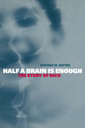 Half a Brain is Enough: The Story of Nico de Antonio M. Battro