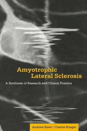 Amyotrophic Lateral Sclerosis: A Synthesis of Research and Clinical Practice de Andrew Eisen