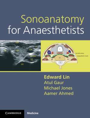 Sonoanatomy for Anaesthetists de Edward Lin