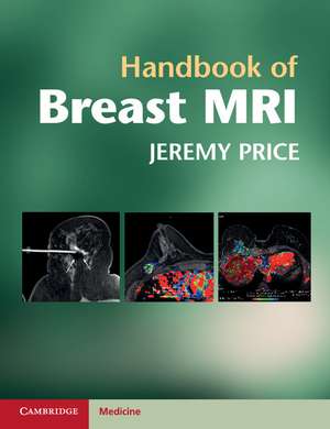 Handbook of Breast MRI de Jeremy Price