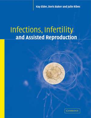 Infections, Infertility, and Assisted Reproduction de Kay Elder