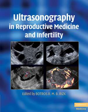 Ultrasonography in Reproductive Medicine and Infertility de Botros R. M. B. Rizk