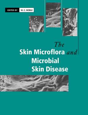 The Skin Microflora and Microbial Skin Disease de W. C. Noble