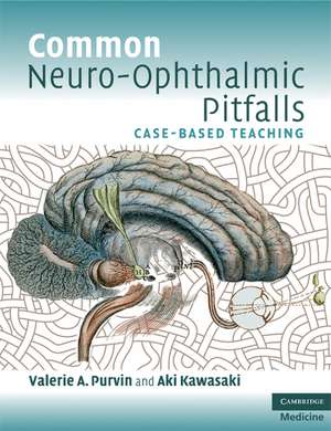 Common Neuro-Ophthalmic Pitfalls: Case-Based Teaching de Valerie A. Purvin