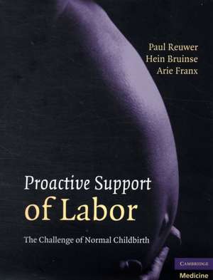 Reuwer, P: Proactive Support of Labor