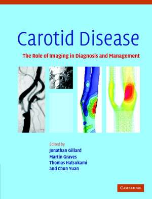 Carotid Disease: The Role of Imaging in Diagnosis and Management de Jonathan Gillard