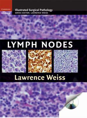 Lymph Nodes de Lawrence M. Weiss