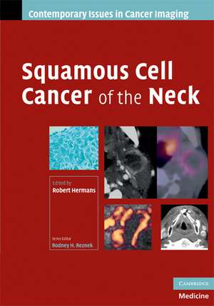 Squamous Cell Cancer of the Neck de Robert Hermans