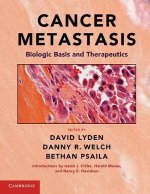 Cancer Metastasis: Biologic Basis and Therapeutics de David Lyden