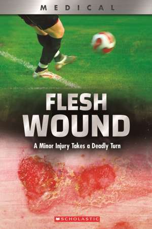 Flesh Wound: A Minor Injury Takes a Deadly Turn (Xbooks) de Shea Phillips