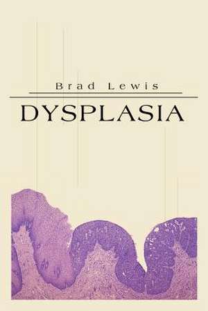 Dysplasia de Brad B. Lewis