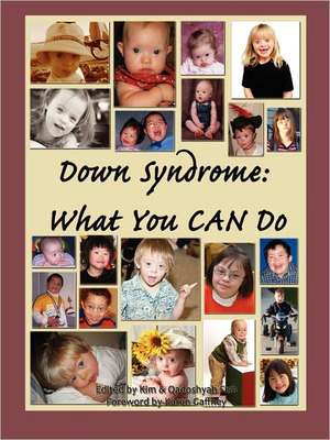 Down Syndrome: What You CAN Do de Qadoshyah Fish