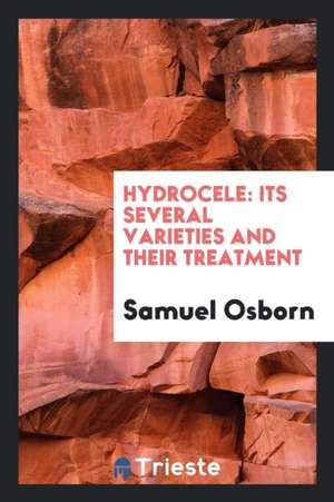 Hydrocele, Its Varieties and Their Treatment de Sam Osborn