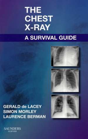 The Chest X-Ray: A Survival Guide de Gerald de Lacey