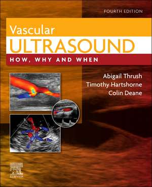 Vascular Ultrasound: How, Why and When de Abigail Thrush