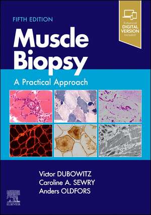 Muscle Biopsy: A Practical Approach de Victor Dubowitz