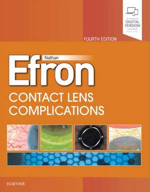 Contact Lens Complications de Nathan Efron