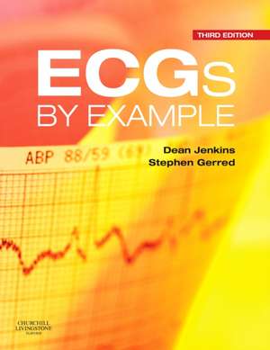 ECGs by Example de Dean Jenkins