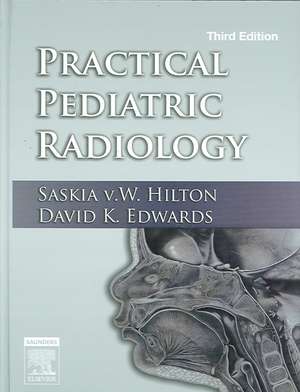 Practical Pediatric Radiology de Saskia v. W. Hilton