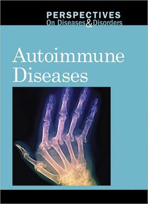 Autoimmune Diseases de Jacqueline Langwith