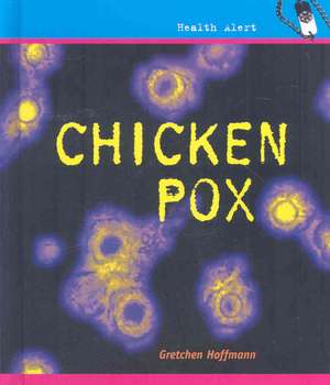 Chickenpox de Gretchen Hoffmann