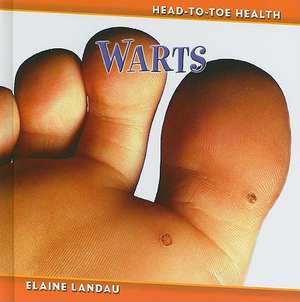 Warts de Elaine Landau