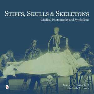 Stiffs, Skulls & Skeletons: Medical Photography and Symbolism de Stanley B. Burns, MD MD